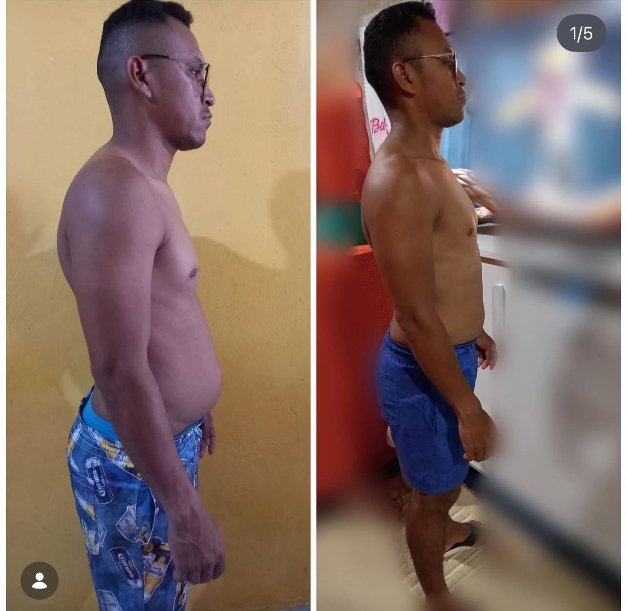 Evolução Antes e Depois